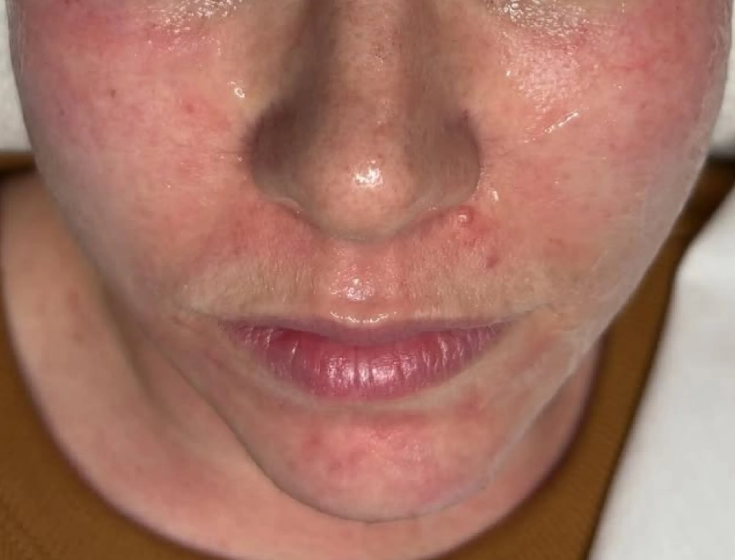 best time to get facial