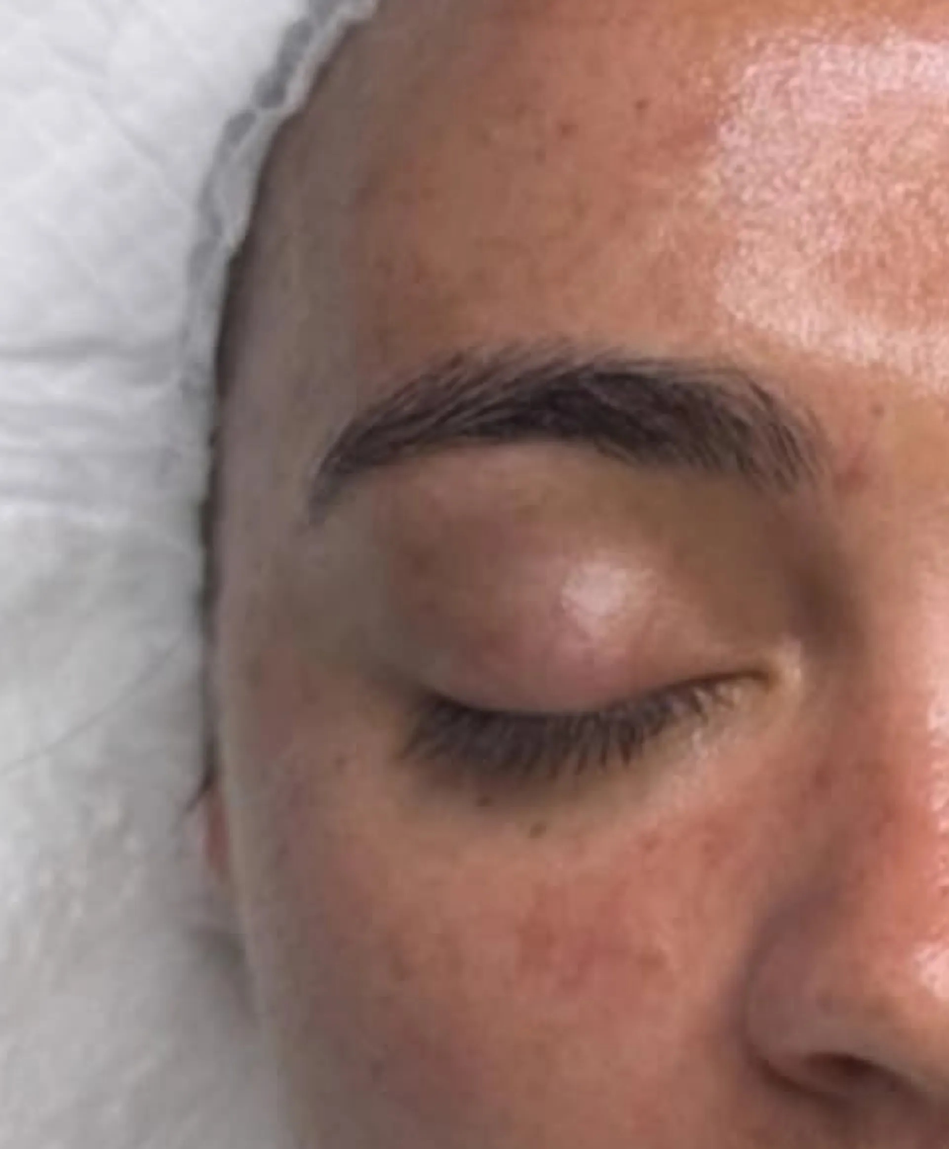 monthly facials benefits