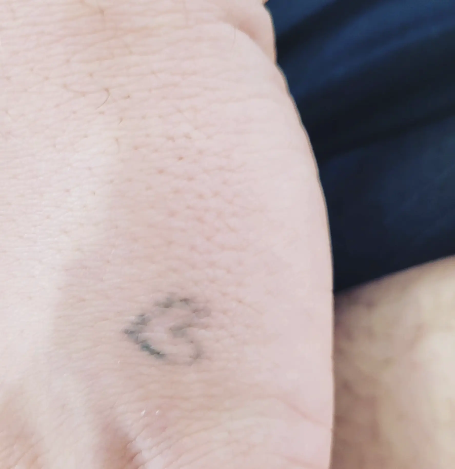 tattoo removal course victoria